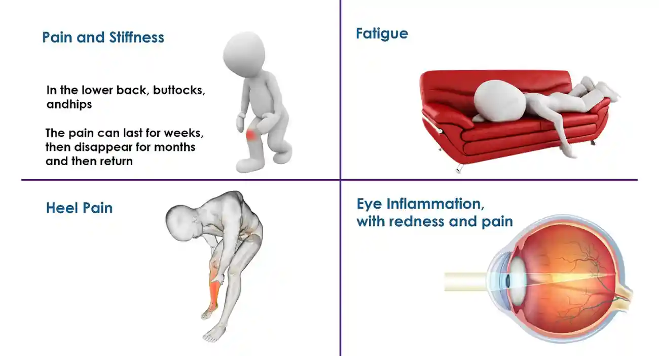 pain and stiffness