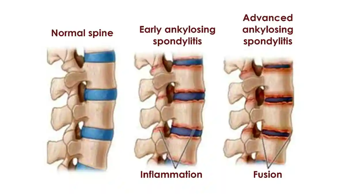 normal spine