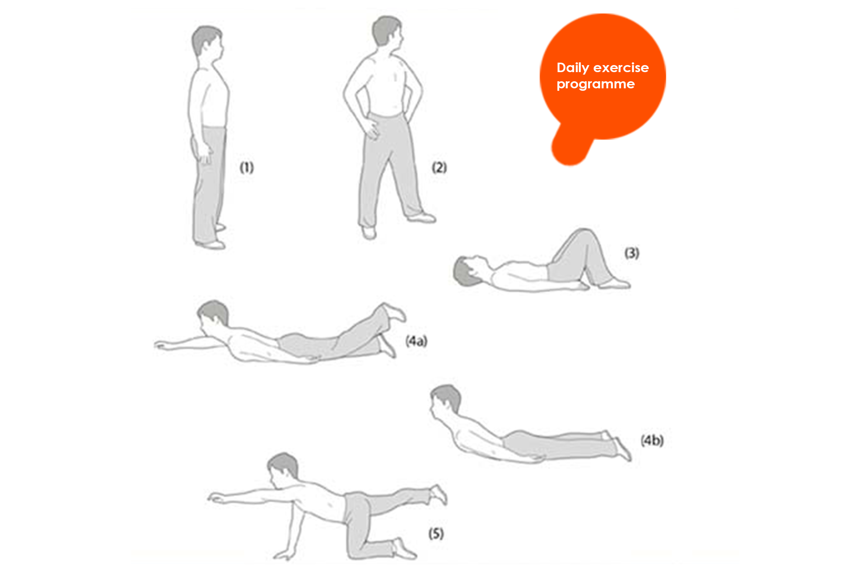 ankylosing-spondylitis